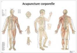 La formation