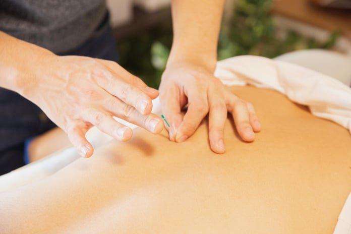 Acupunture